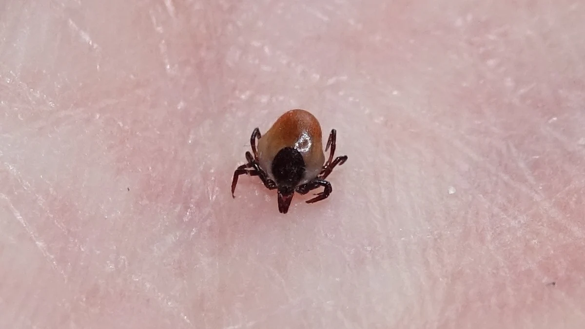 Preventing tick bites, and what to do if you get one